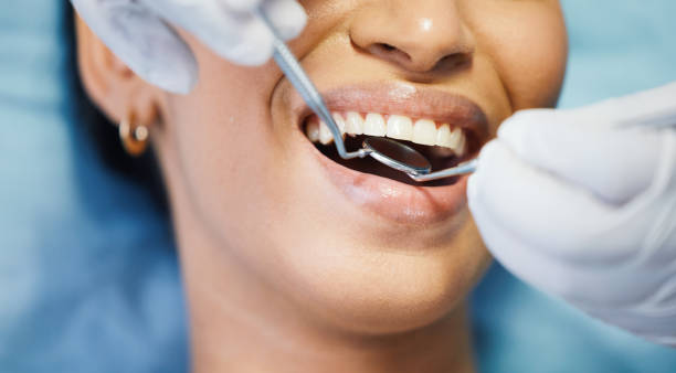 Best Same-Day Emergency Dental Services in Lincoln Center, KS